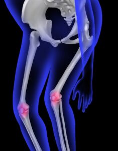 human bone, anatomy, knee pain, patella, leg pain, orthopedics